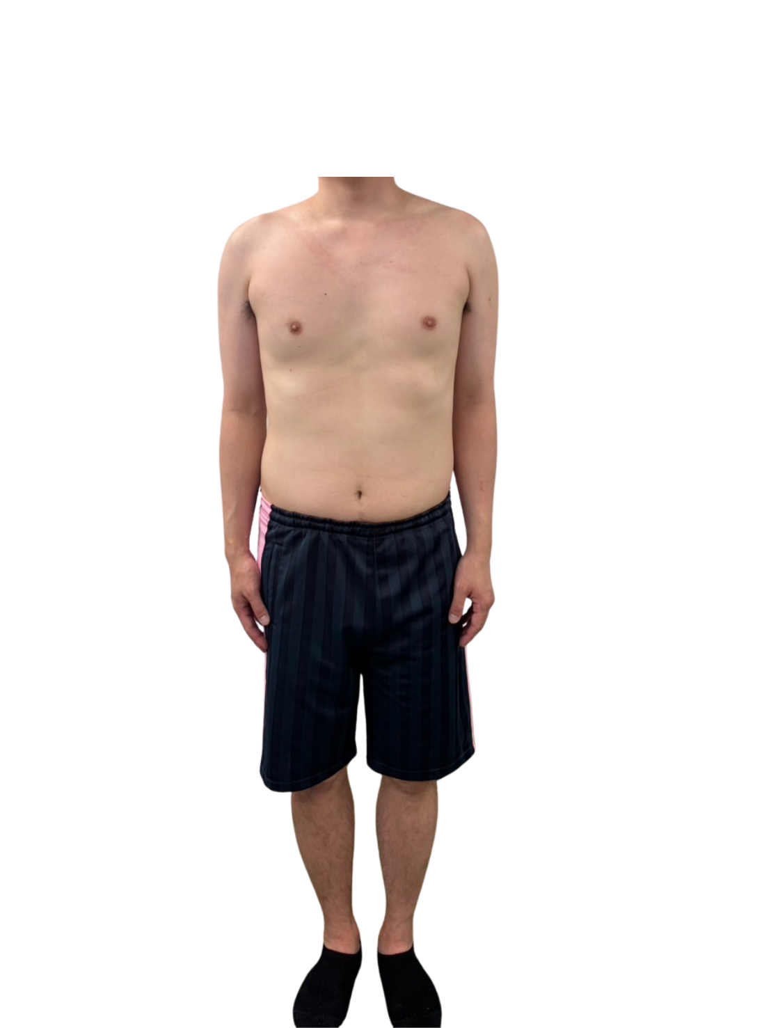 40代男性のアフター写真