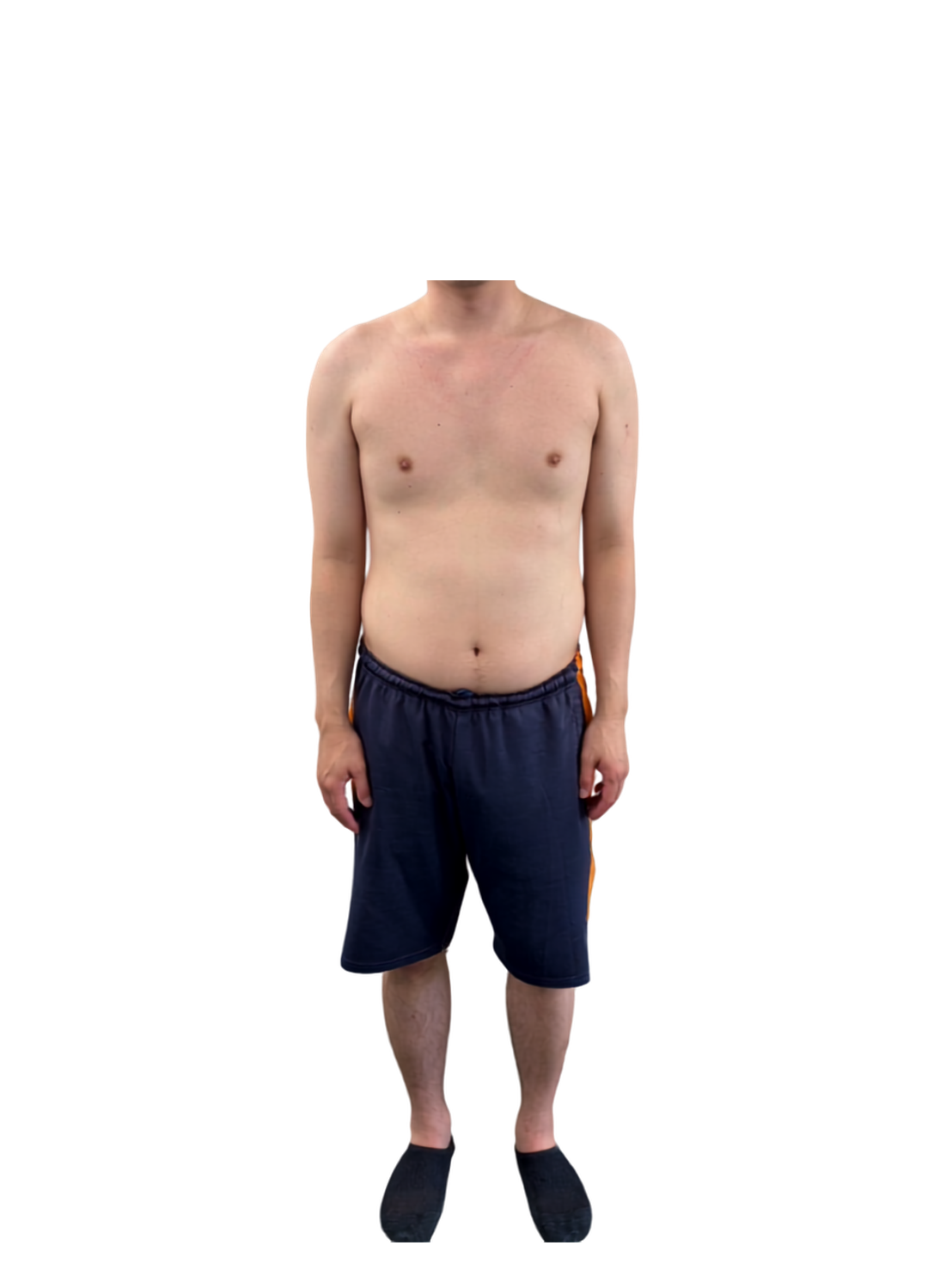 40代男性のビフォー写真