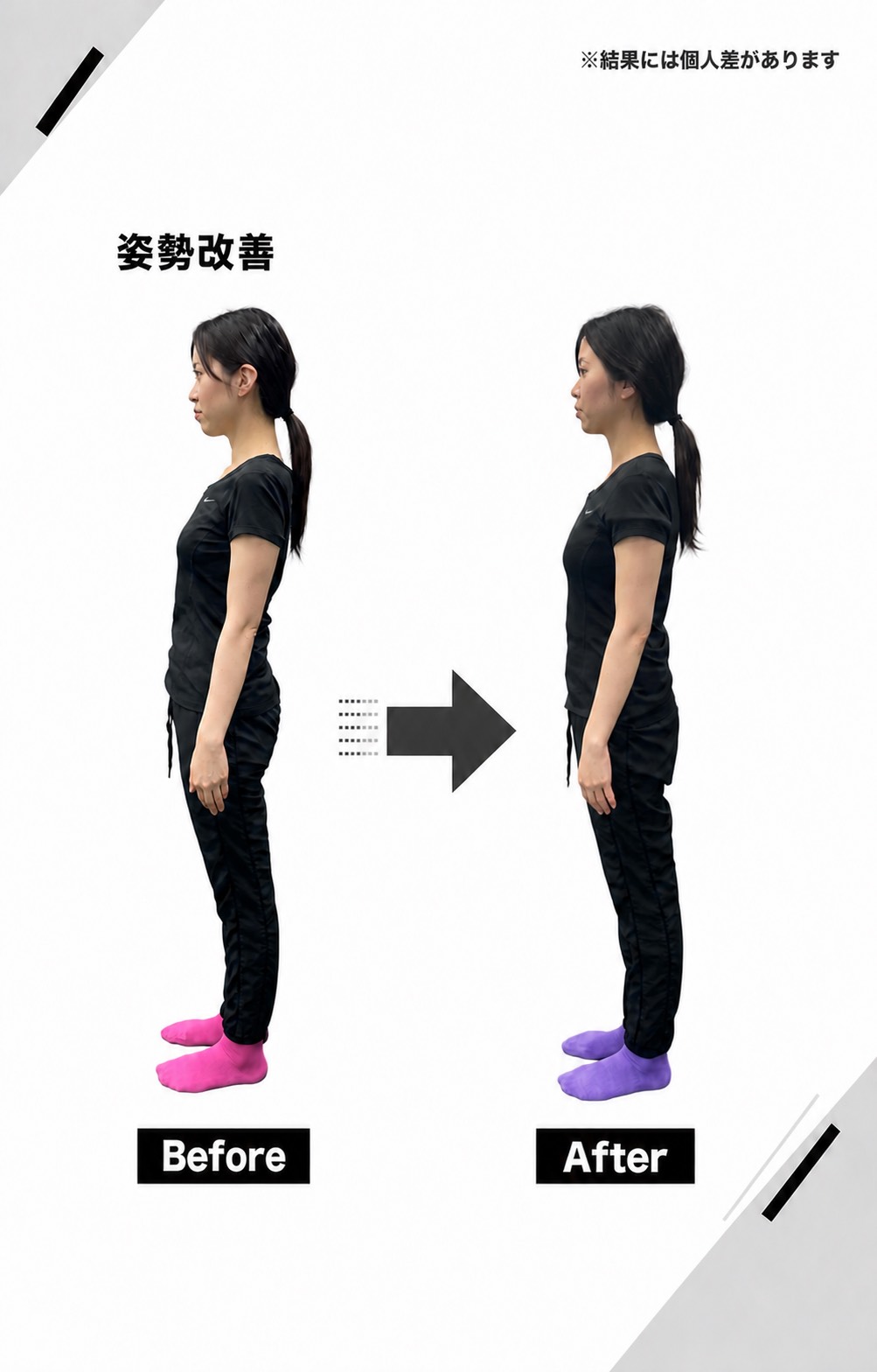 巻き肩と反り腰の姿勢改善ビフォーアフター写真