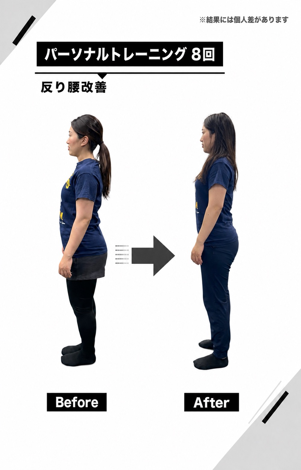 全8回で反り腰を改善したビフォーアフター写真