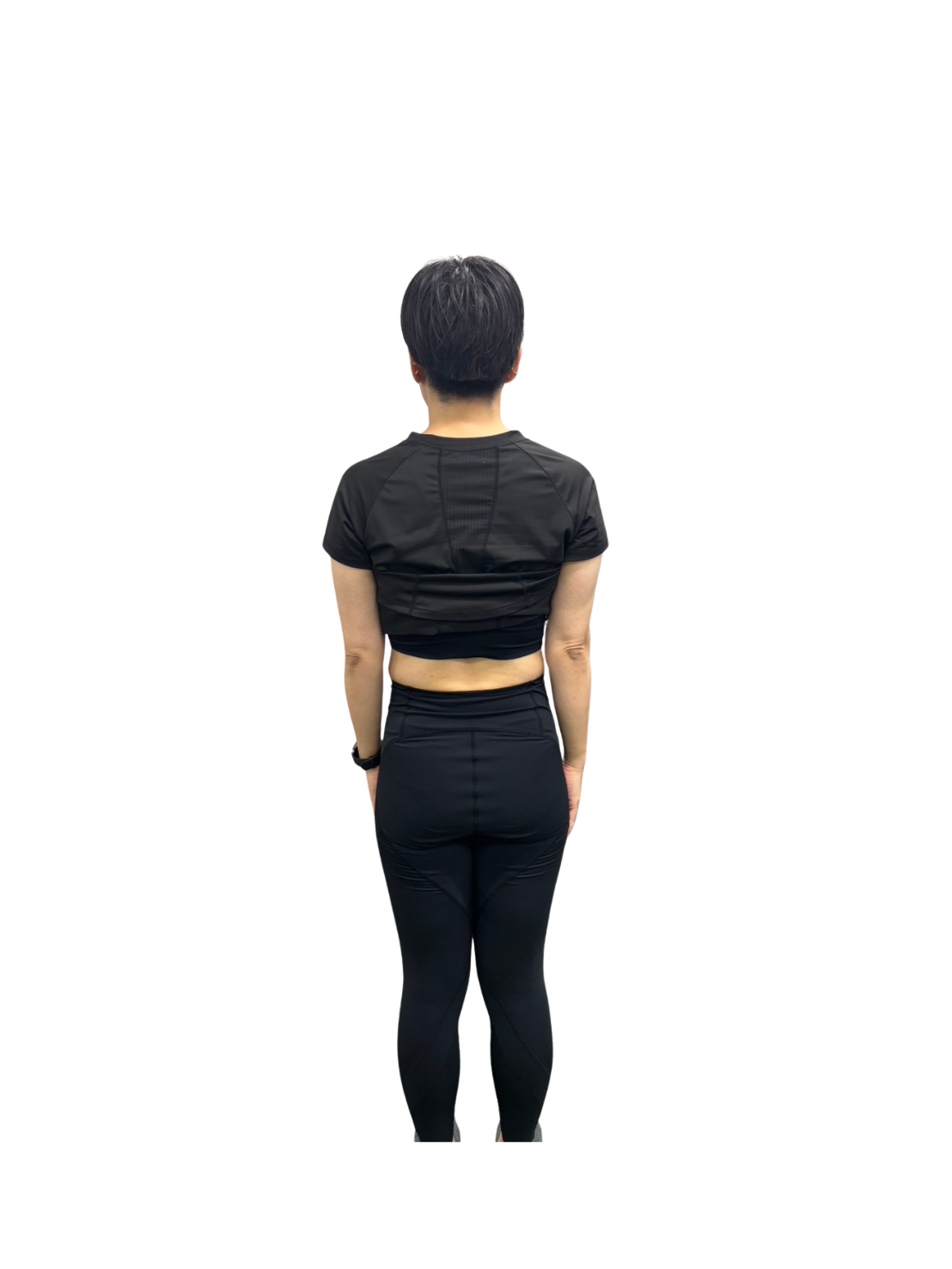 50代女性のアフター写真